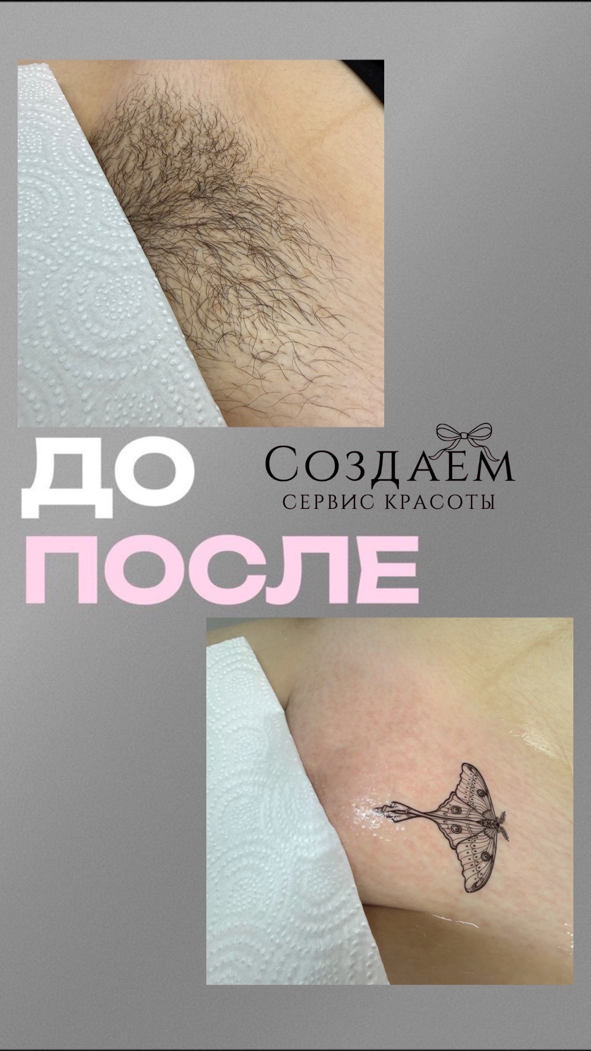 Депиляция